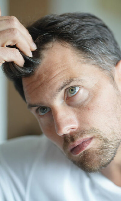 6 Health Conditions That Trigger Severe Hair Loss