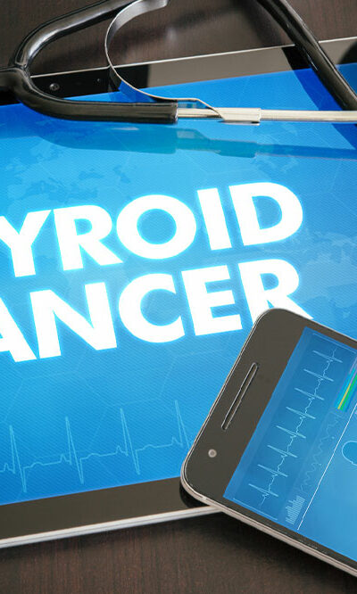 6 Silent Signs of Thyroid Cancer