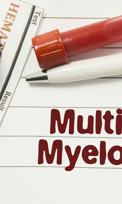7 Multiple Myeloma Signs to be Aware of