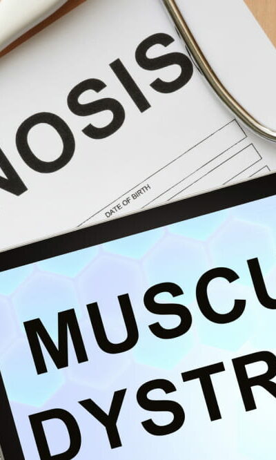 9 common types of muscular dystrophy and their symptoms