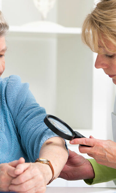 11 silent signs of skin cancer