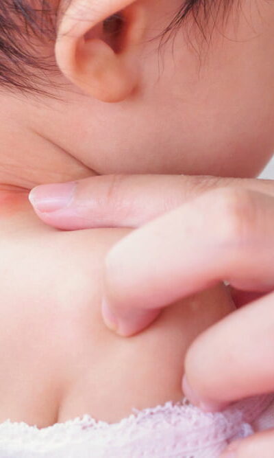 17 soap ingredients that could trigger eczema in kids