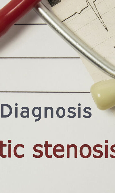 14 ways to prevent and manage aortic stenosis