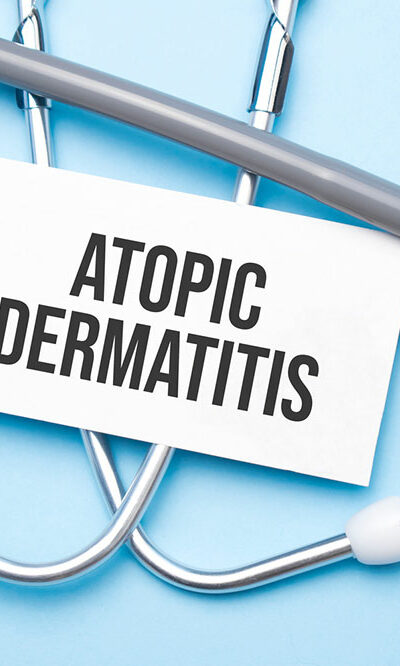 Atopic Dermatitis – Symptoms, Causes, and Remedies