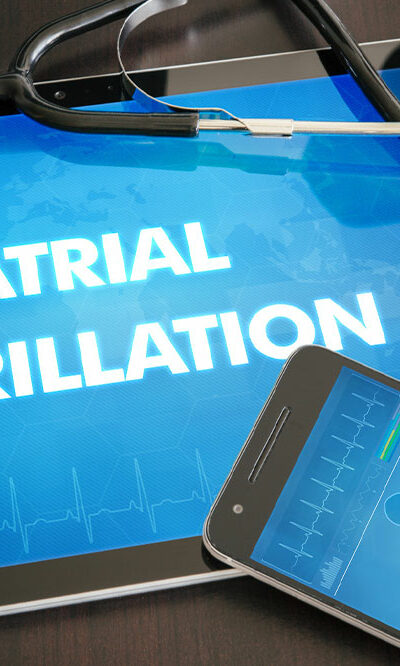 Atrial Fibrillation – Causes, Signs, and Remedies
