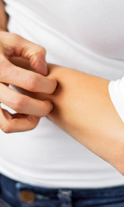 Habits to Adopt and Avoid to Manage Eczema