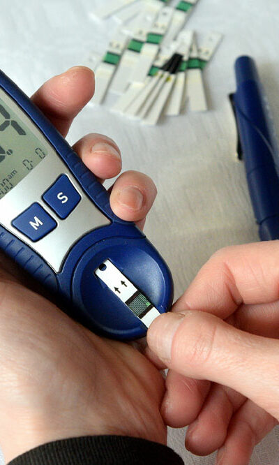 Hyperglycemia – Causes, Symptoms, and Management