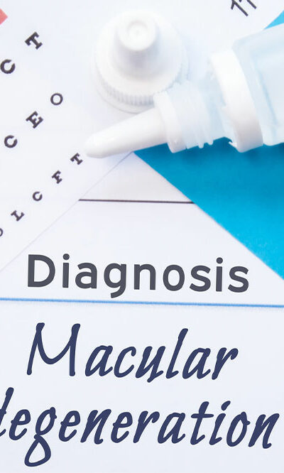 Macular Degeneration – Causes, Symptoms, and More