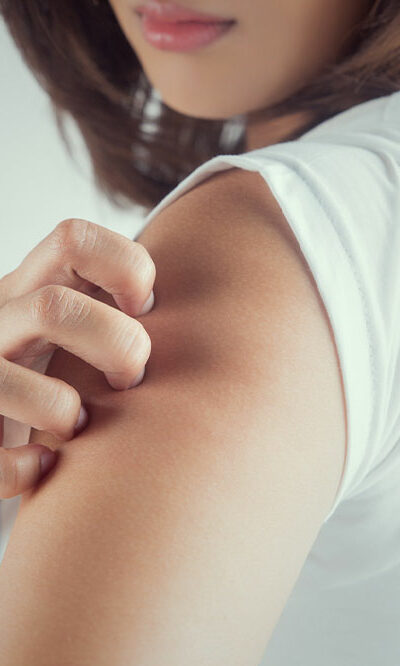 Must-know Triggers of Itchy Skin