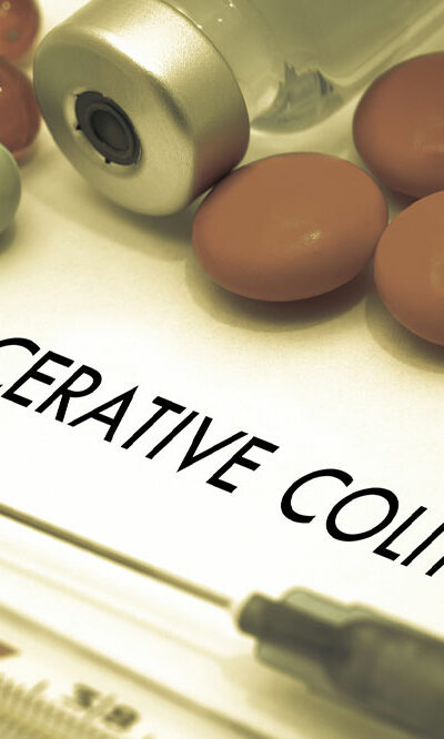 Signs and complications of ulcerative colitis